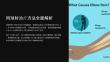 《网球肘的治疗方法》课件