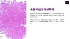 《小肠神经内分泌肿瘤》课件