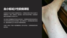 《血小板减少性紫癜》课件
