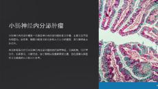 《小肠神经内分泌肿瘤》课件
