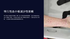 《特发性血小板减少性紫癜》课件