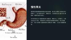 《慢性胃炎》课件