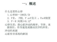 心律不齐深度解析论坛培训课件