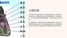 《心律失常》课件