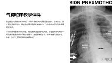 气胸课件教学