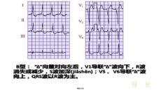 【大學課件資源整合】心電圖最新課件12