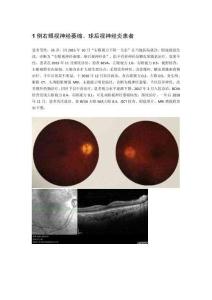 1例右眼视神经萎缩、球后视神经炎患者