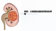 肾癌课件教学