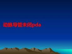 动脉导管未闭pdaPPT课件
