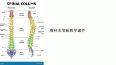 脊柱关节病教学课件