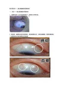 教大家目診——通過看眼睛來預(yù)測疾病