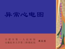 異常心電圖