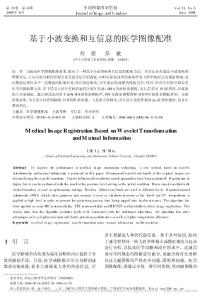 基于小波变换和互信息的医学图像配准