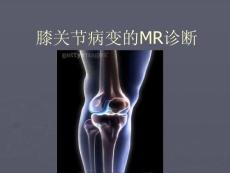 膝关节病变MR诊断