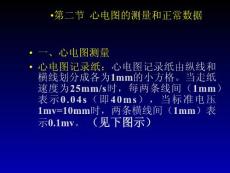 第二節(jié)正常心電圖