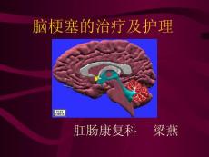 脑梗塞护理