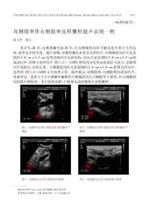 双侧隐睾伴右侧隐睾皮样囊肿超声表现一例