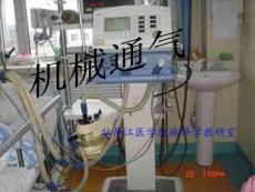机械通气