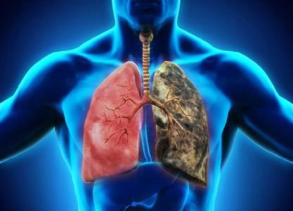 肺部疾病診斷與治療