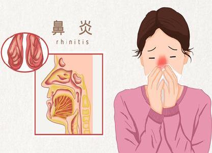 鼻炎的癥狀及治療方法